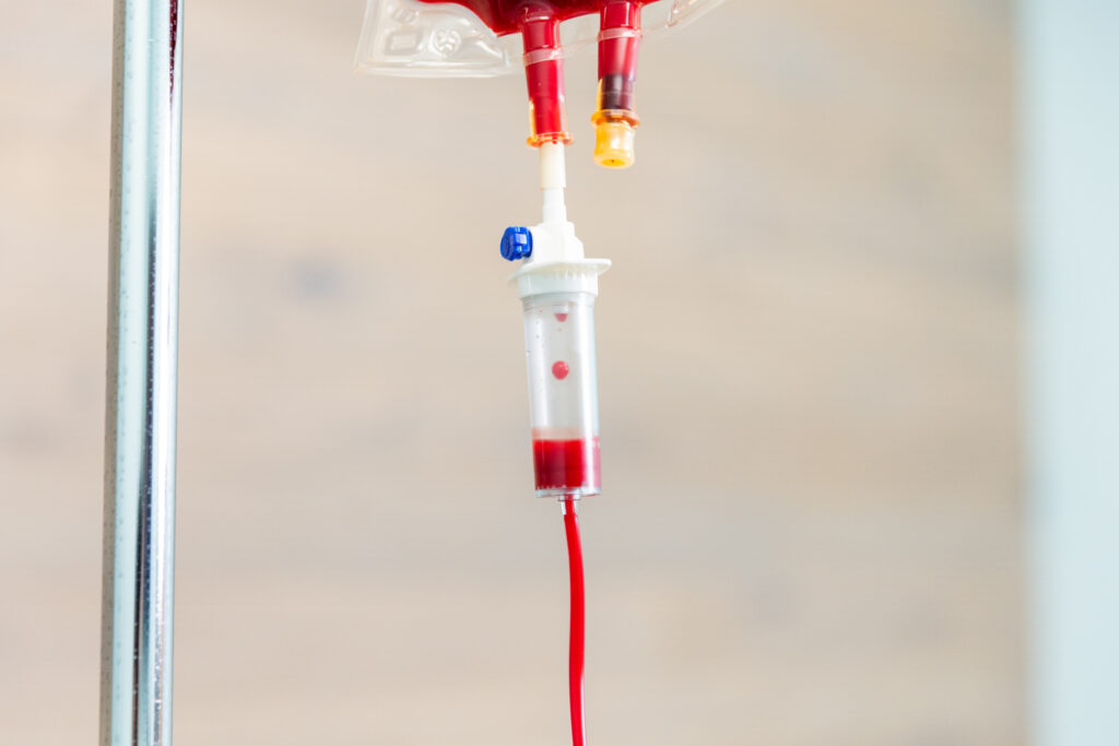 Tube that contains blood taken from patient's arm. The blood is being passed through a specialized diffuser filter and cleansed of germs, heavy metals, and toxins as part of an advanced treatment for ozone therapy near Cedar Rapids.
